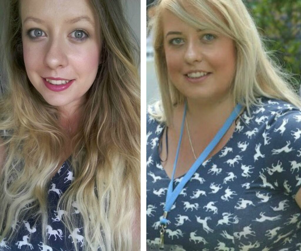 Weight loss before and after comparison
