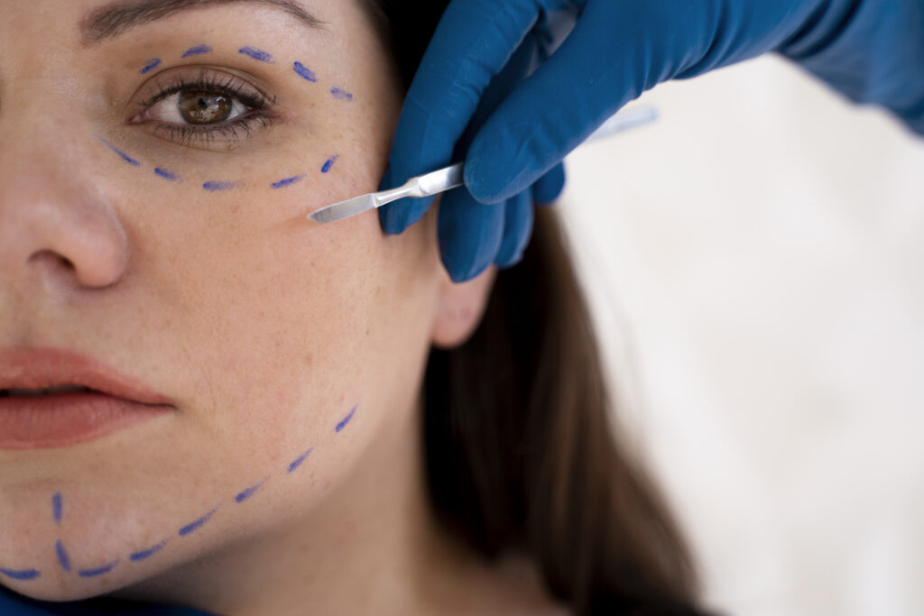Face marked for surgery