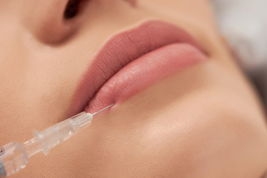 Lips being injected with filler