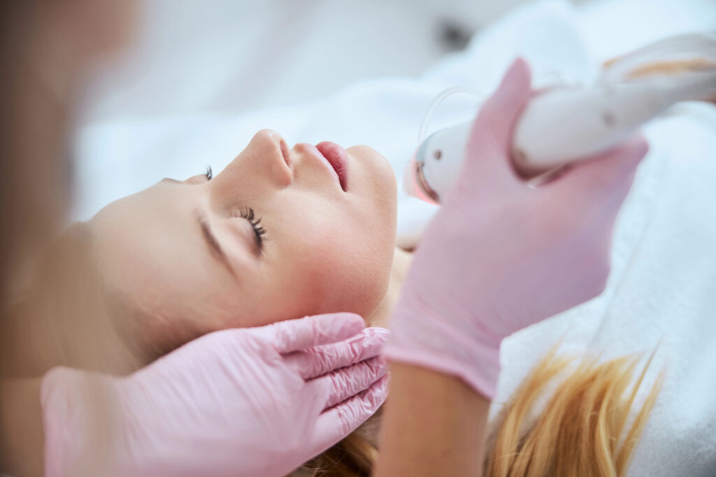 Blonde woman receiving microneedling treatment