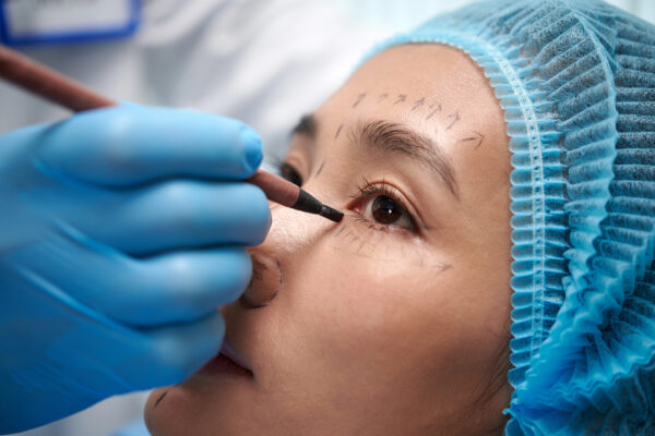 Close up of a woman being prepped for surgery