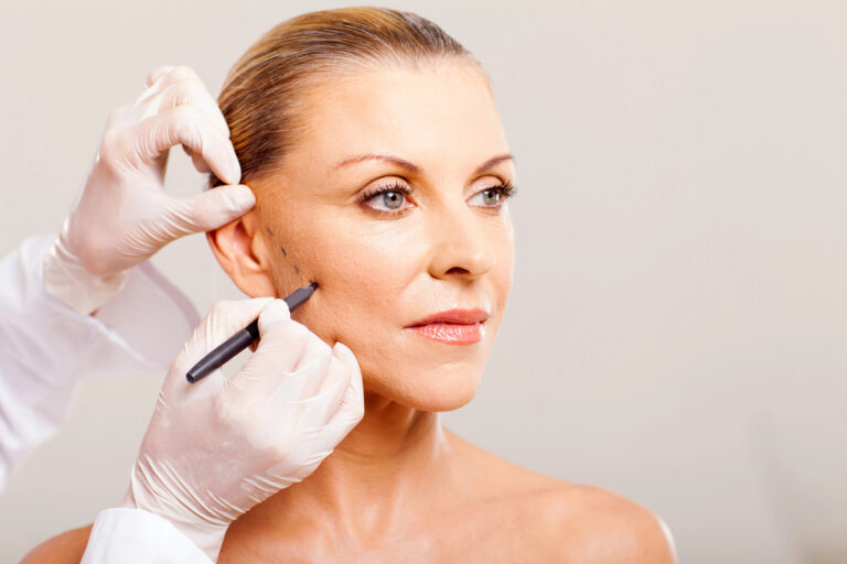 I Want to Look Younger Without Looking Overdone: Can a Facelift Help?